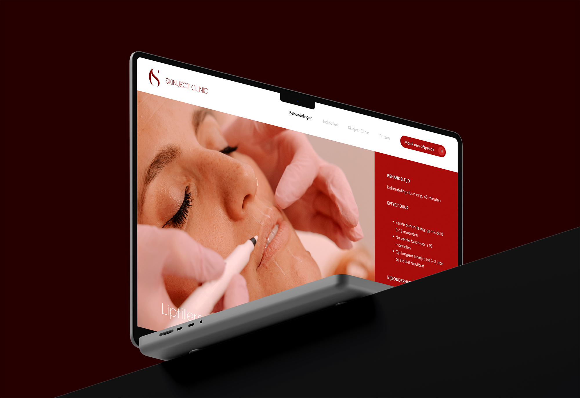 Lead generation